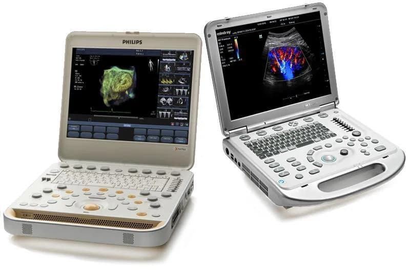 Portable ultrasound equipment